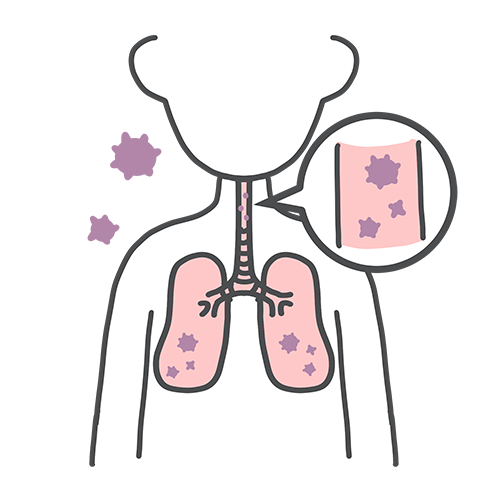のどや肺の中で増えていくイラスト